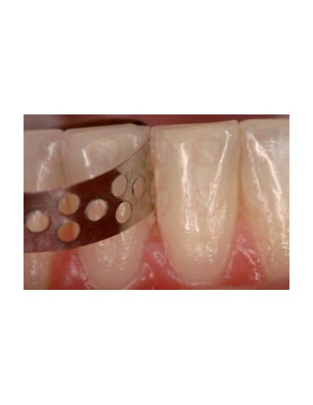 Tiras de profialsix Horico