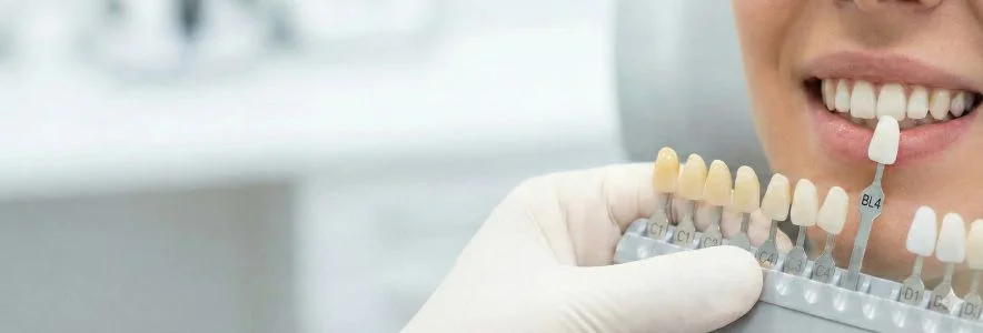 ODONTOLOG&Iacute;A EST&Eacute;TICA